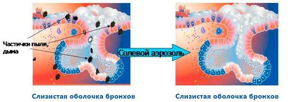 Галотерапия при курении